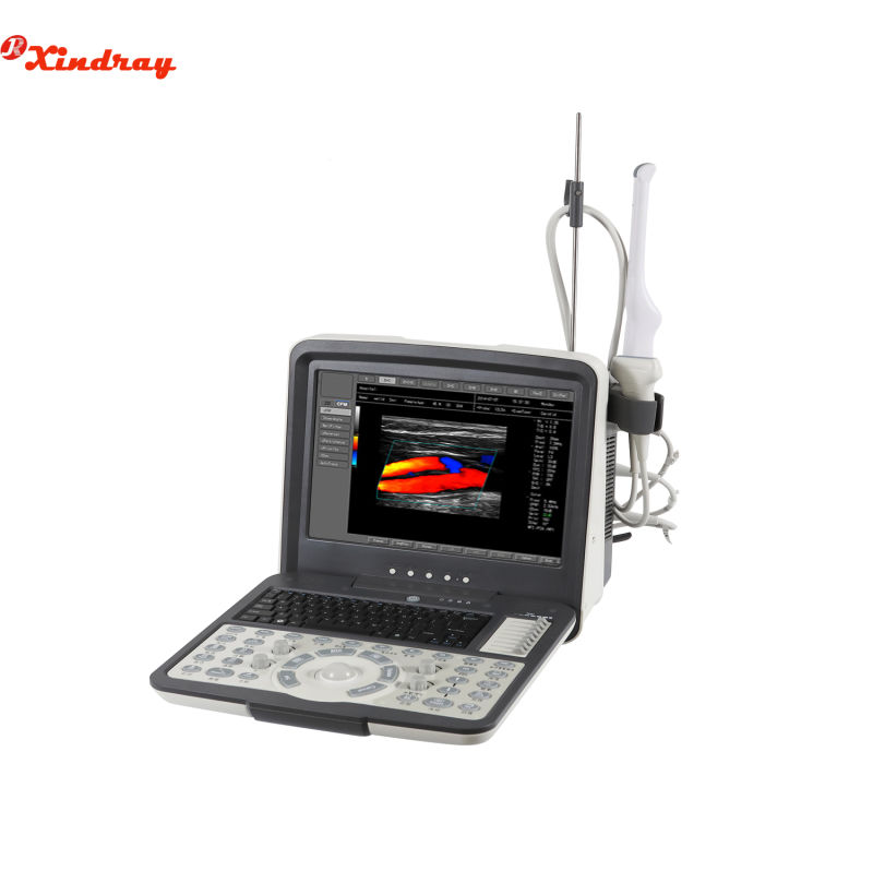 Handheld High Image Quality Portable Ultrasound Scanner