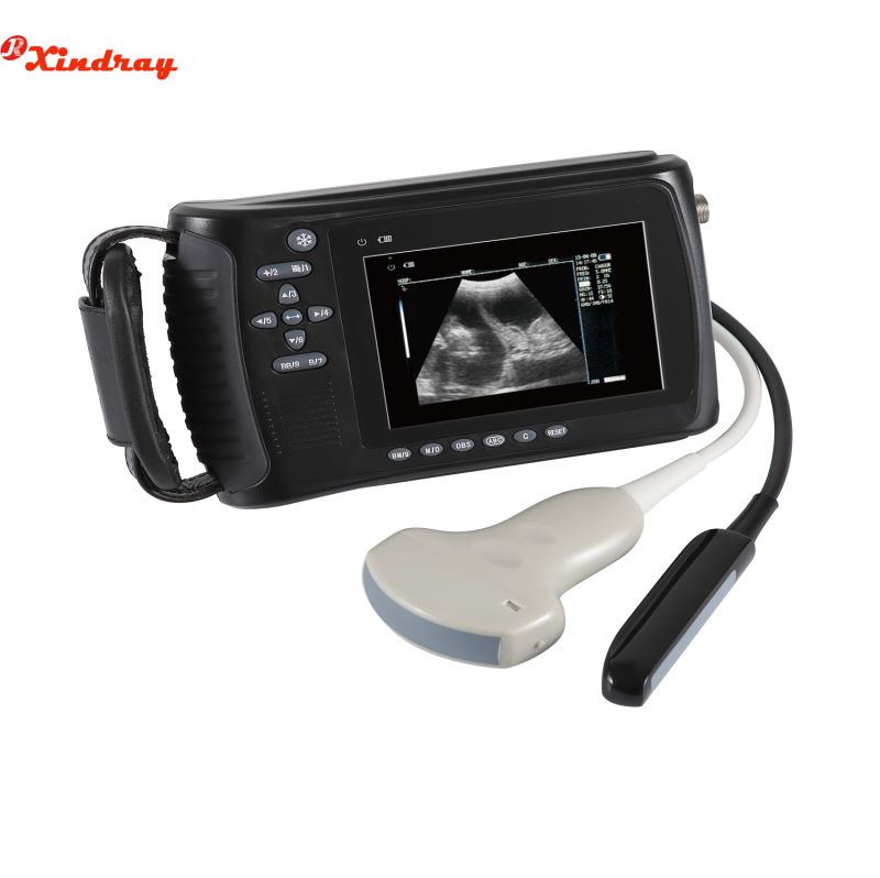 Handheld High Image Quality Portable Ultrasound Scanner