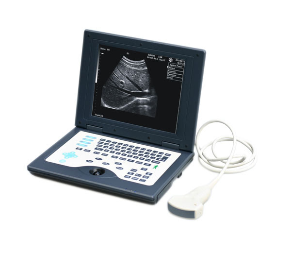 Laptop B/W Ultrasound Imaging System (Am-5800)