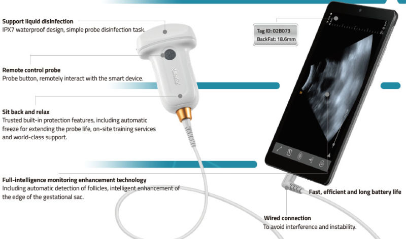 Portable USB Ultrasonic Imaging System Ultrasound for Hospital