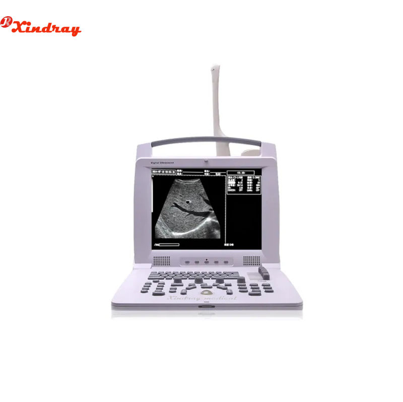 Handheld High Image Quality Portable Ultrasound Scanner