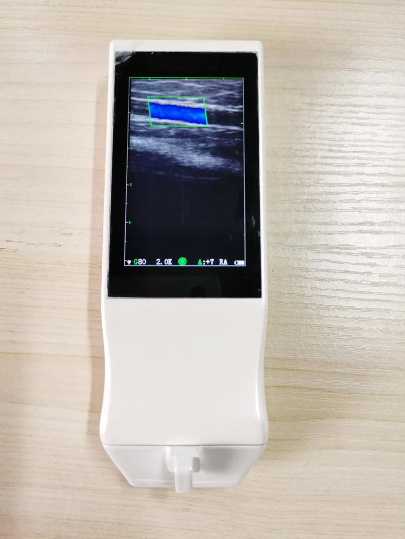 Wireless Ultrasound Probe Mslpu74 with High Quality Image
