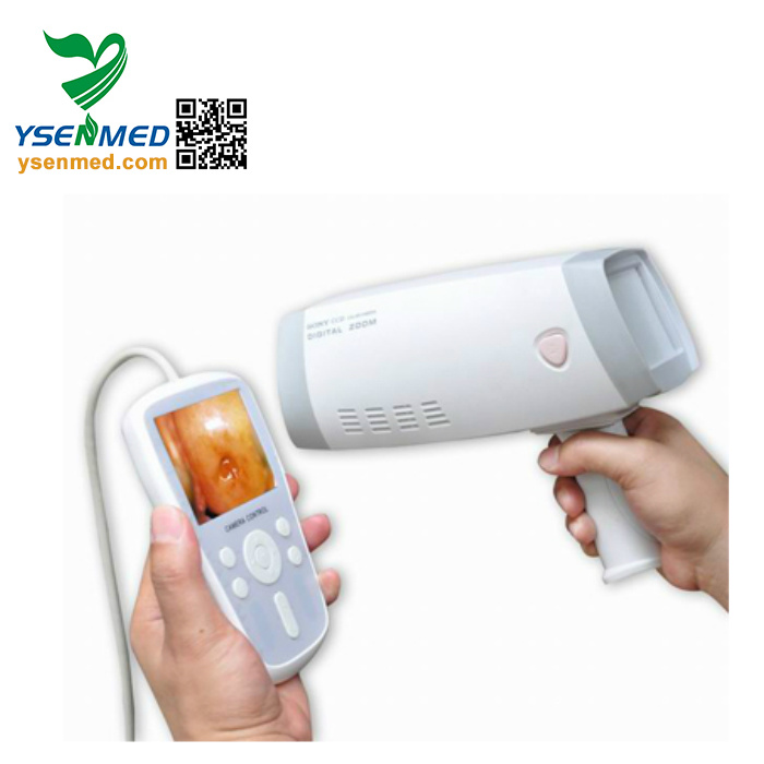 Handheld Gynecology Electronic HD Video Colposcope
