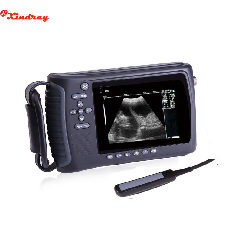 Handheld High Image Quality Portable Ultrasound Scanner