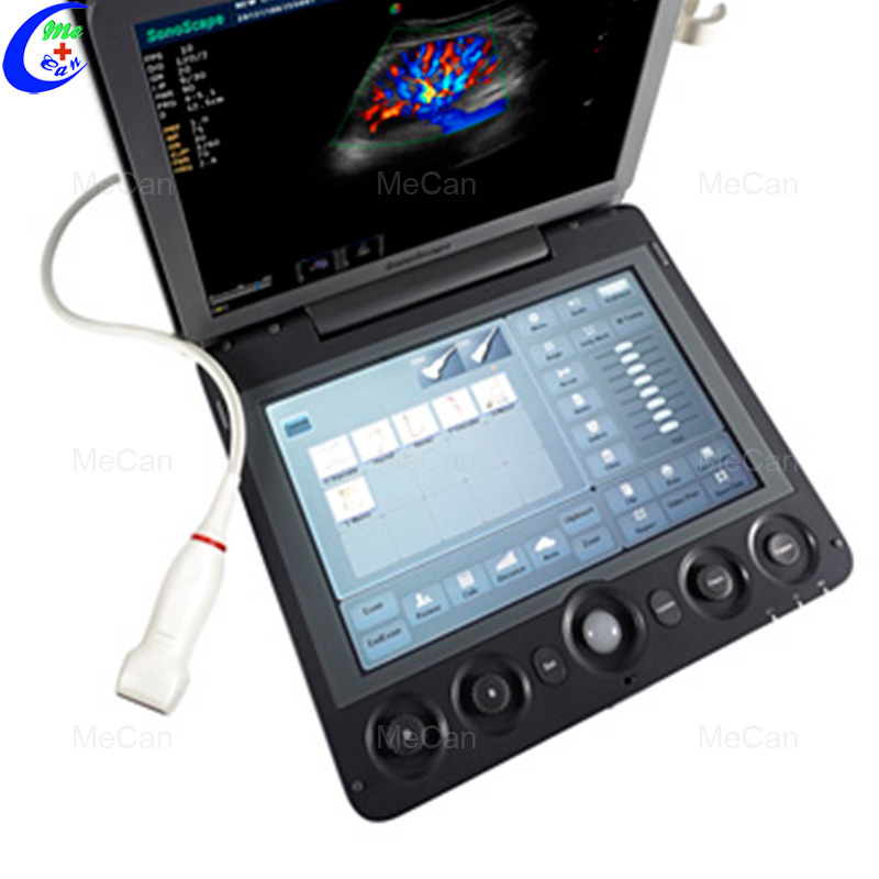 Sonoscape S9 Ultrasound, Sonoscape S9 Best Price Sonoscape S9 Best Support