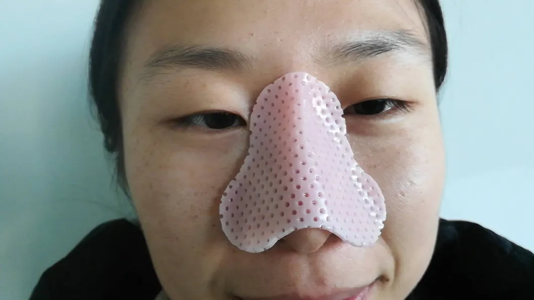 External Nasal Splint Thermoplastic Orthopaedic Nose Cast for Broken Nose