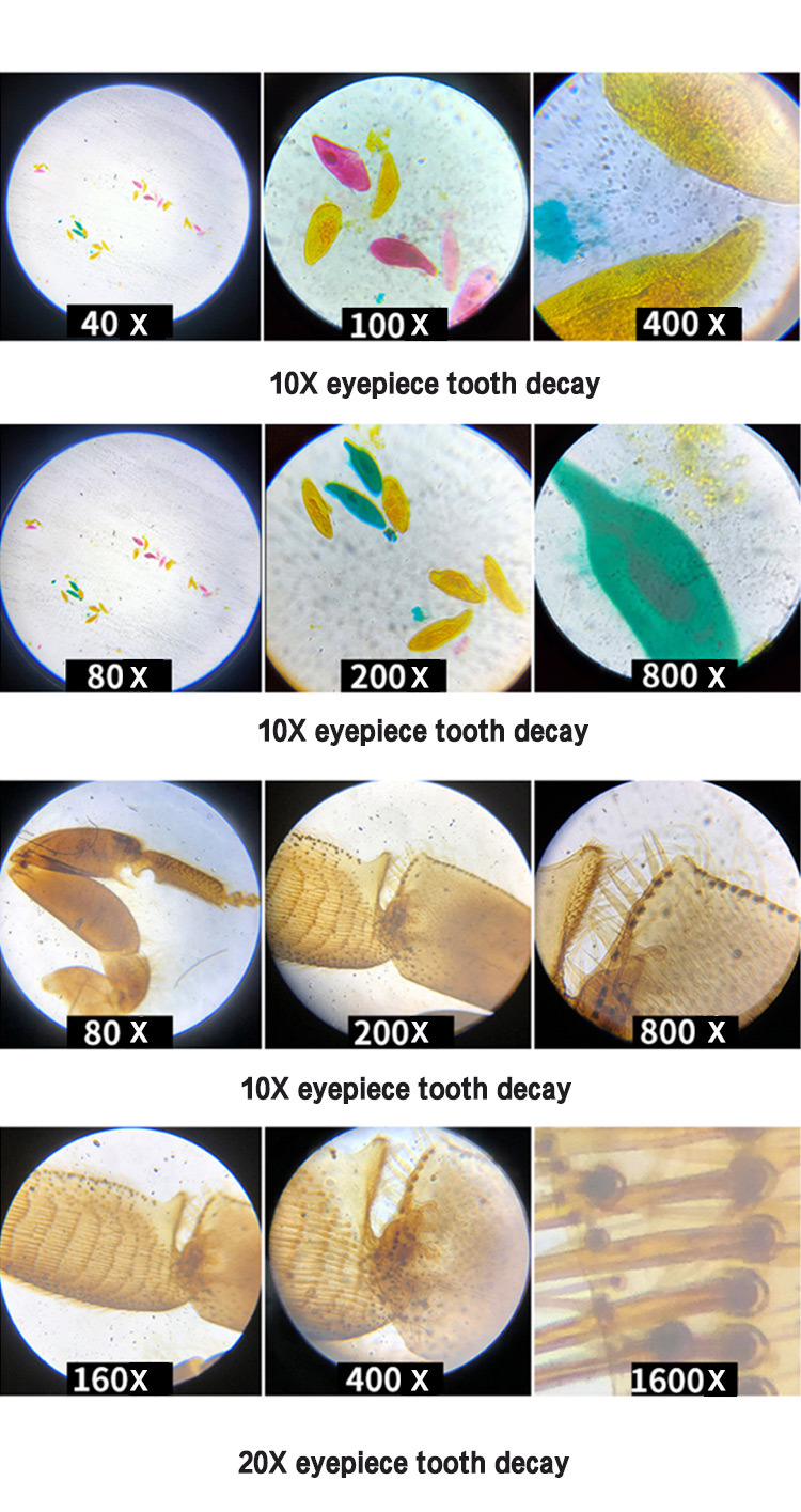 Widely Used in Biology Medical Microscope Professional Microscope Monocular