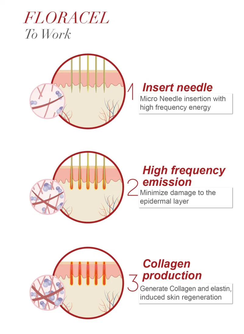 RF Micro-Needle Skin Rejuvenation/Skin Care Beauty Medical Equipment