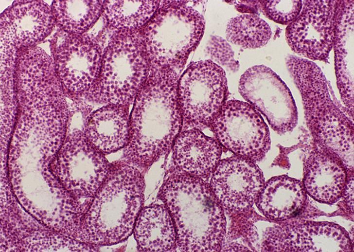 Bestscope BS-2020m Biological Microscope for High School Student Biological Microscope
