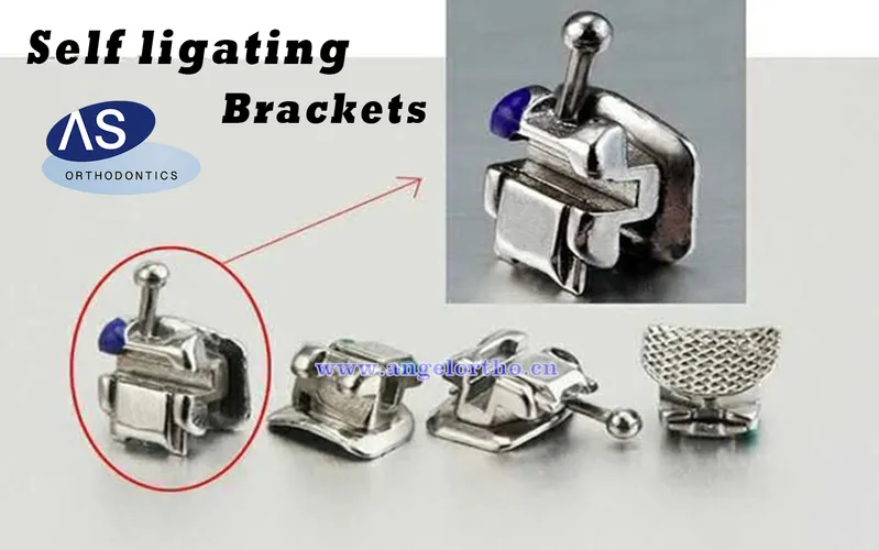 MIM Orthodontics Metal Self-Ligating Brackets Dental Brackets with High Quality 1g