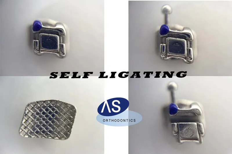 as Orthodontic Self Lligating Brackets / MIM Metal Self Ligating Braces 1g