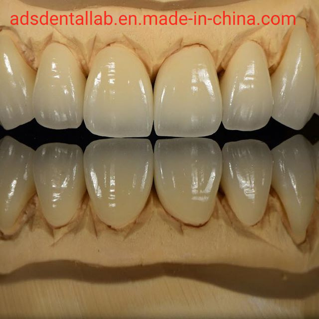Ads Dental Lab All Ceramic Restorations Metal Free Zirconia IPS Emax
