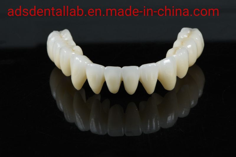 Beautiful Zirconia Crowns and Bridges From Shenzhen Ads Dental Laboratory