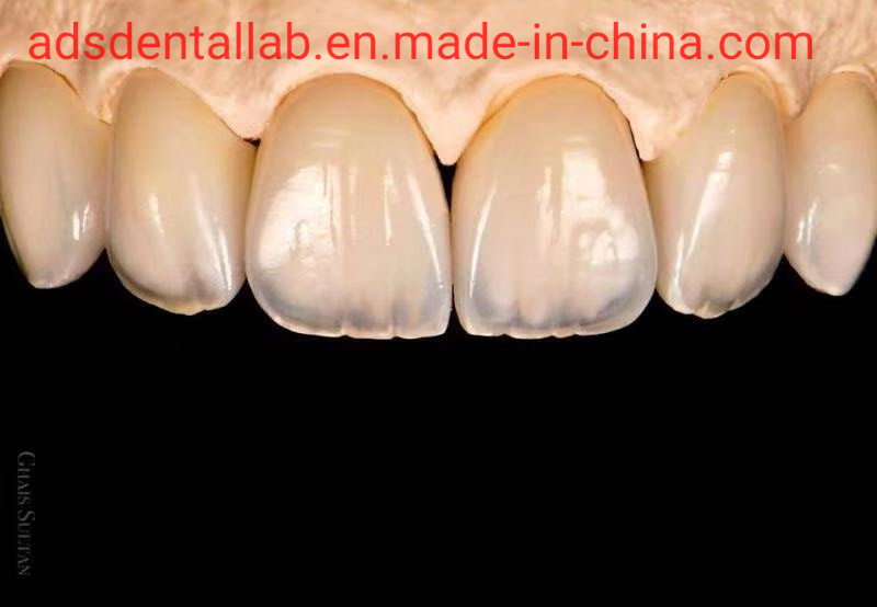 Ads Dental Lab All Ceramic Restorations Metal Free Zirconia IPS Emax