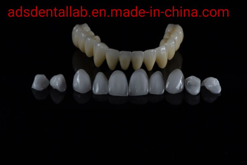 Full Service Zirconia Layered Crown and Bridge Made in Ads Dental Lab