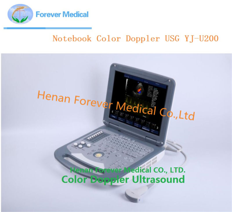 Excellent Quality Medical Equipment Full Digital Ultrasound Diagnostic System
