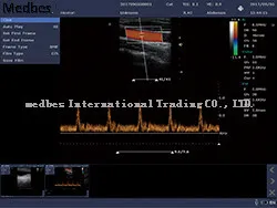 Ophthalmic Ultrasound Ab Scan Machine