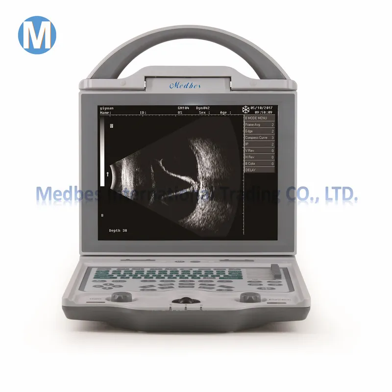 Ophthalmic Ultrasound Ab Scan Machine