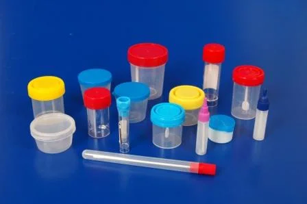 Medical Disposable Plastic Specimen Container Urine Stool Sample Container