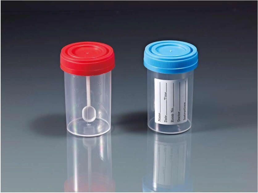 Medical Disposable Plastic Specimen Container Urine Stool Sample Container