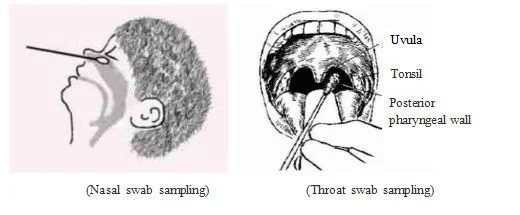 10ml Transport Virus Sampling Specimen Collection Media Swab Tubes for Single Use