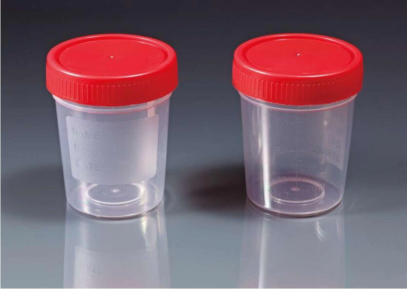 Medical Disposable Plastic Specimen Container Urine Stool Sample Container