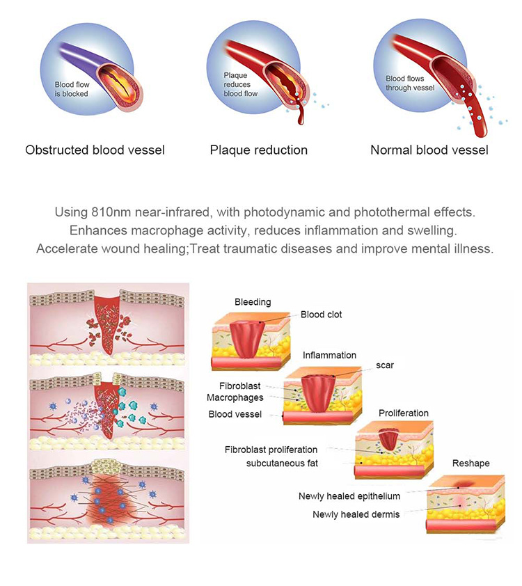 Red Light Therapy Bed Infrared Light Therapy Chamber