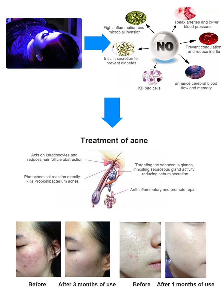 Red Light Therapy Bed Infrared Light Therapy Capsule