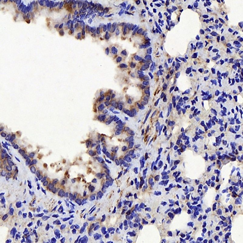 Primary Antibody Anti -Ctgf Polyclonal Rabbit Pab