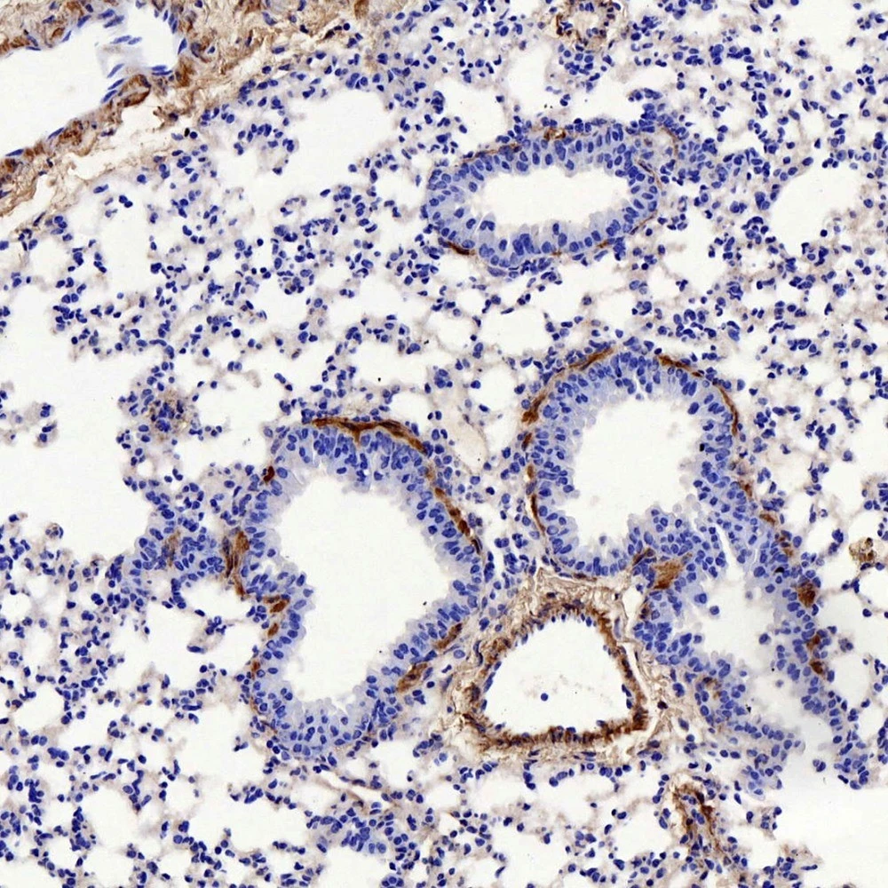Rabbit Anti-Collagen I Polyclonal Antibody