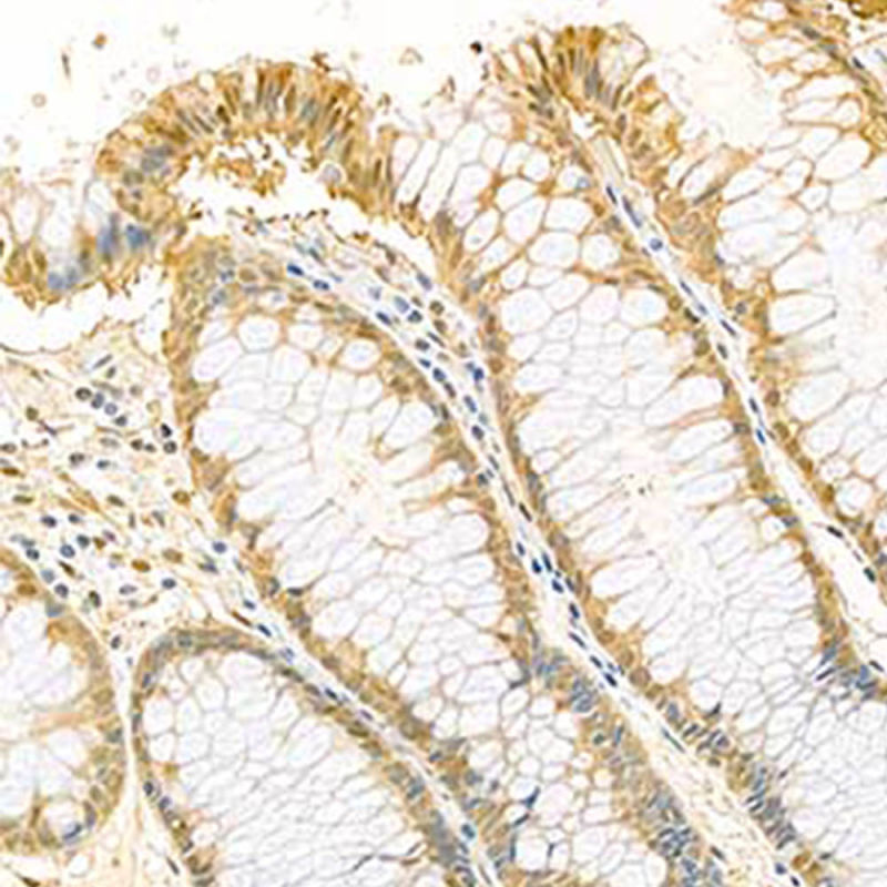 Anti -S100 Alpha 6/Pra Rabbit Primary Polyclonal Antibody