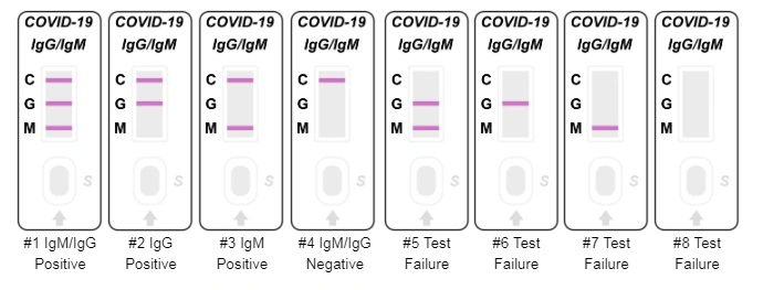 Rapid Blood Test Immunoglobulins Iga, Igg, Igm