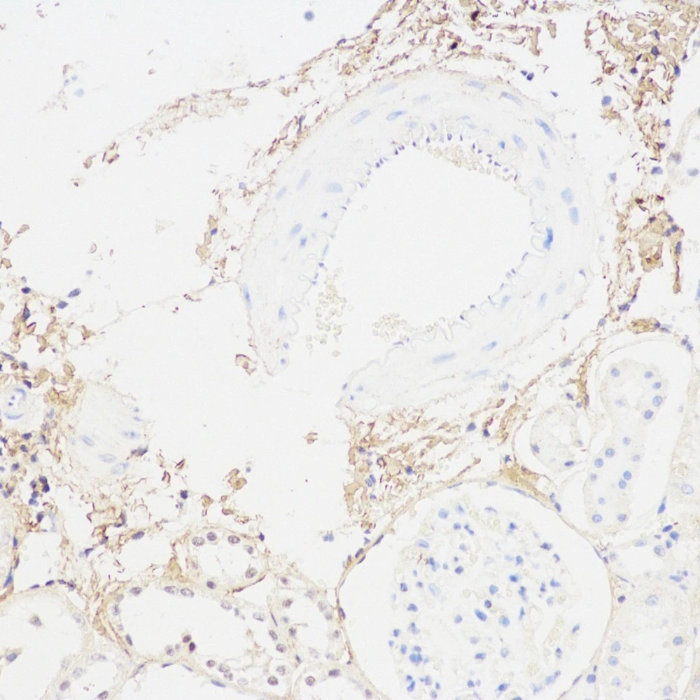 Rabbit Anti-Collageni Polyclonal Antibody Peptides