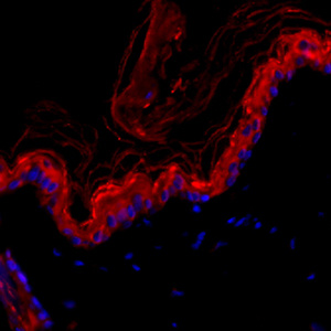Anti -Cytokeratin 1 Rabbit Primary Polyclonal Antibody