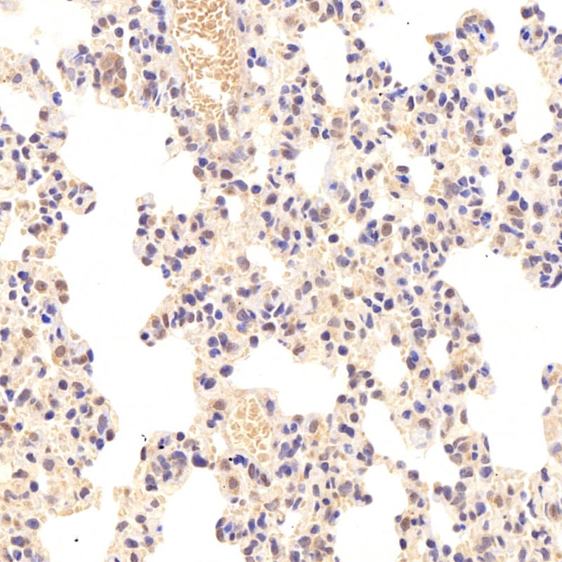 Primary Polyclonal Antibody Anti -Hipk2 Rabbit Pab