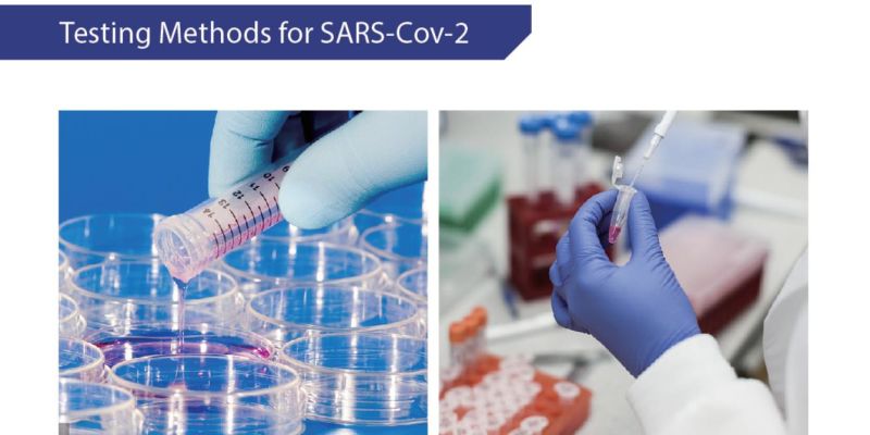 Rapid Neutralizing Antibody Detection Testing for Coving 2019 Virus