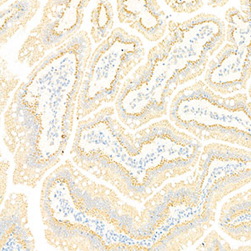 Primary Antibody Anti -Gba Rabbit Pab
