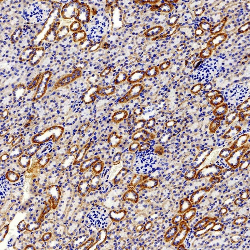 Anti-Beta Catenin Rabbit Polyclonal Antibody