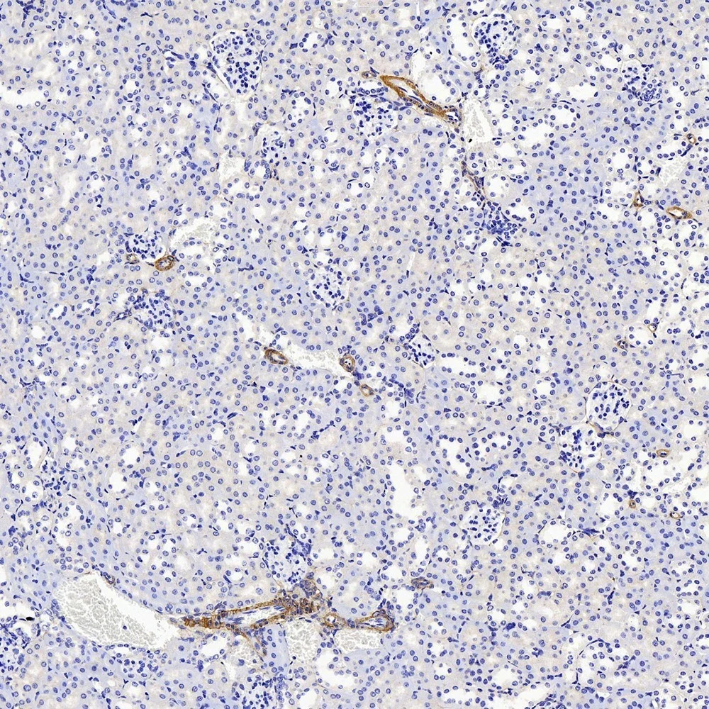 Rabbit Anti-Collagen I Polyclonal Antibody