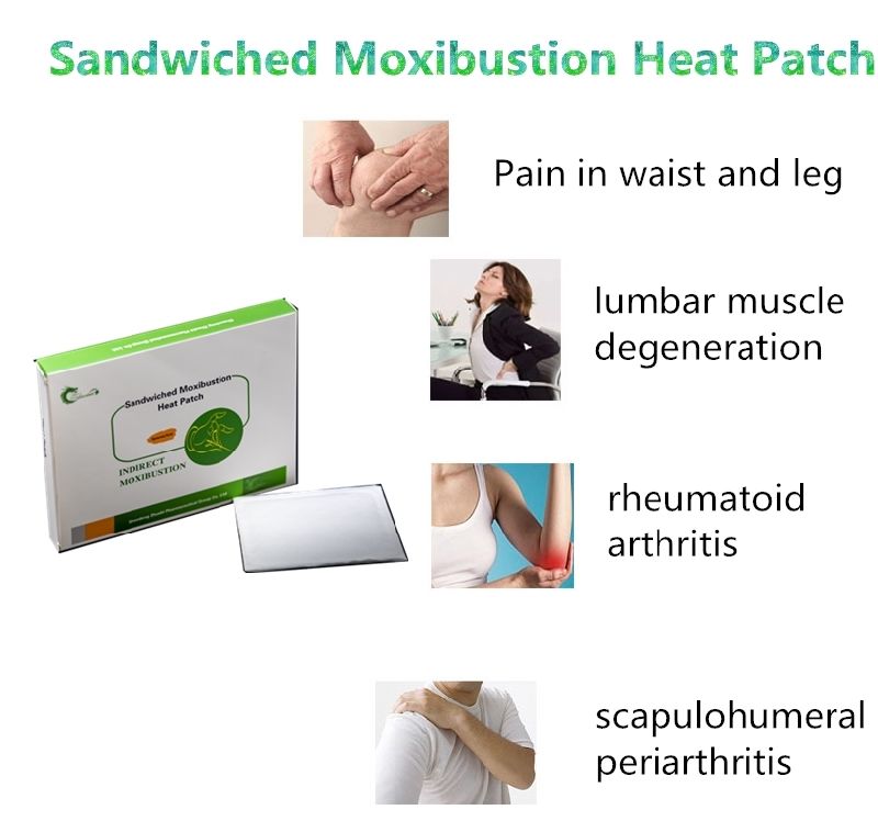 Treatment of Rheumatoid Arthritis Sandwiched Moxibustion