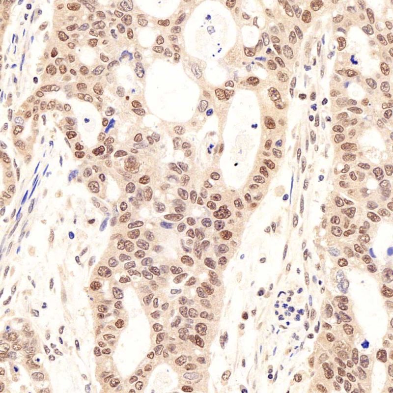 Primary Polyclonal Antibody Anti -Pax2 Rabbit Pab
