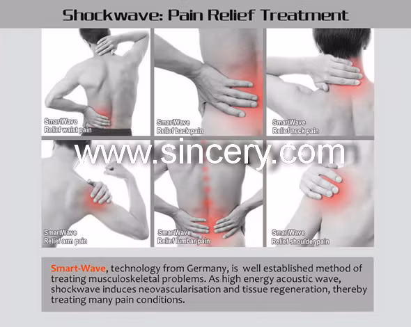 Extracorporeal Shock Wave Therapy Equipment Shock Wave Physiotherapy