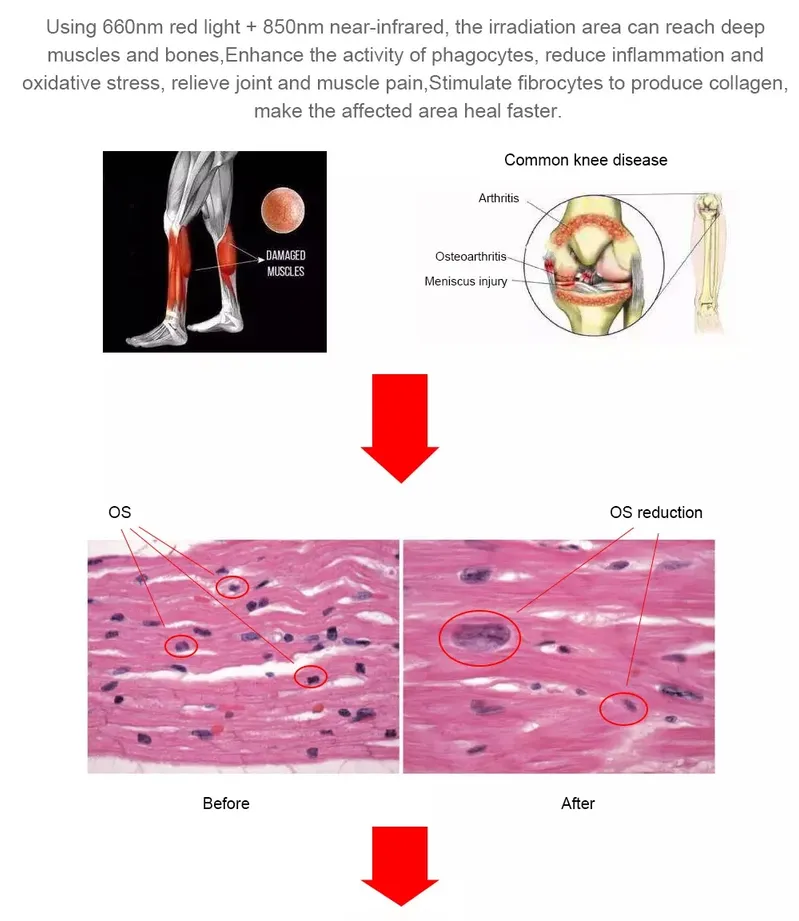 Photomodulation Body Fat Burning Infrared Red LED Light Therapy Panels