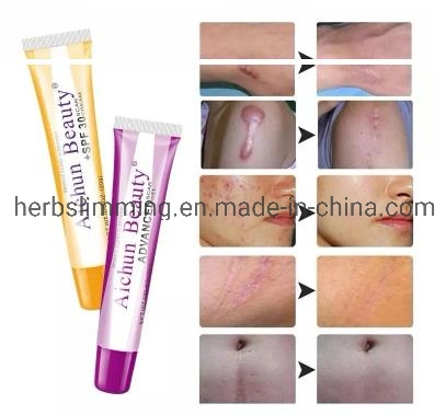 New Aichun Handy Scar Removal Cream Anti Acne Scar Gel