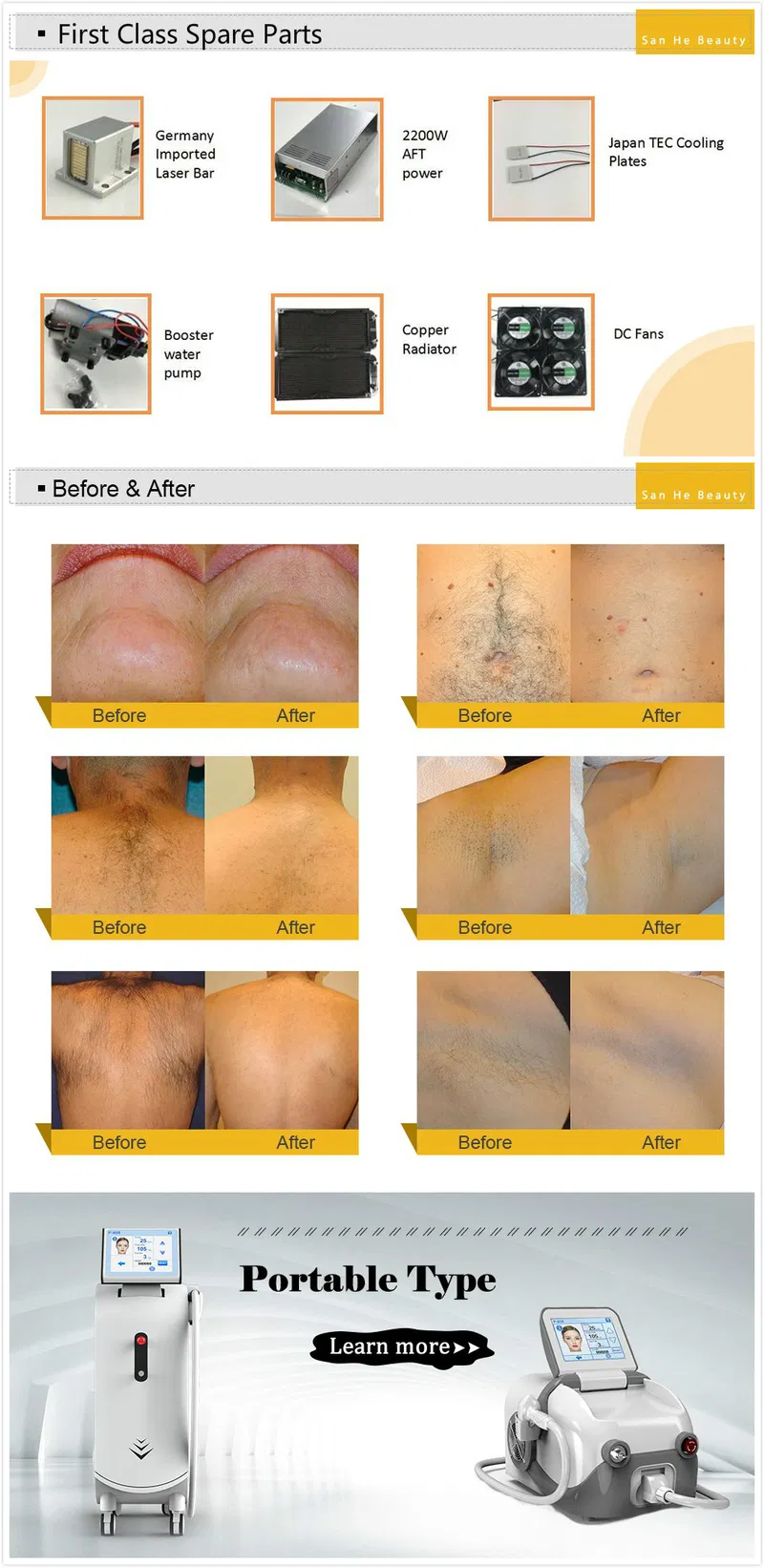 Soprano Ice Depilacion Laser Hair Removal 808 Laser