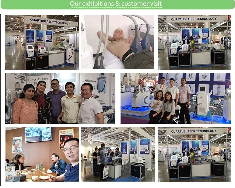 Q Switch Laser Pico Laser Tattoo Removal Machine