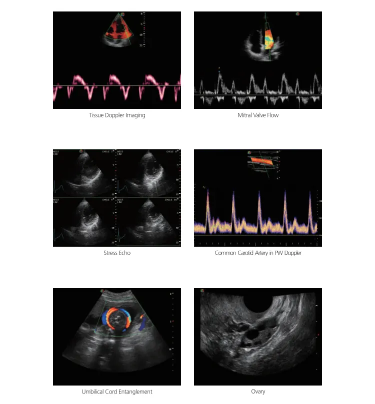 Sonoscape S8 Portable 4D Color Doppler Ultrasound Portable Laptop Ultrasound Machine Sonoscape Ultrasound Price