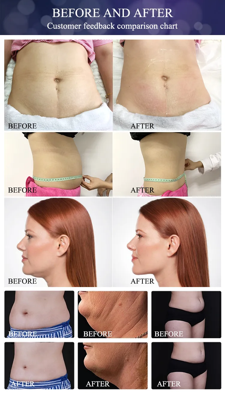 2020newest Cryolipolysis Muntifunctional Fat Freezing Slimming Machine