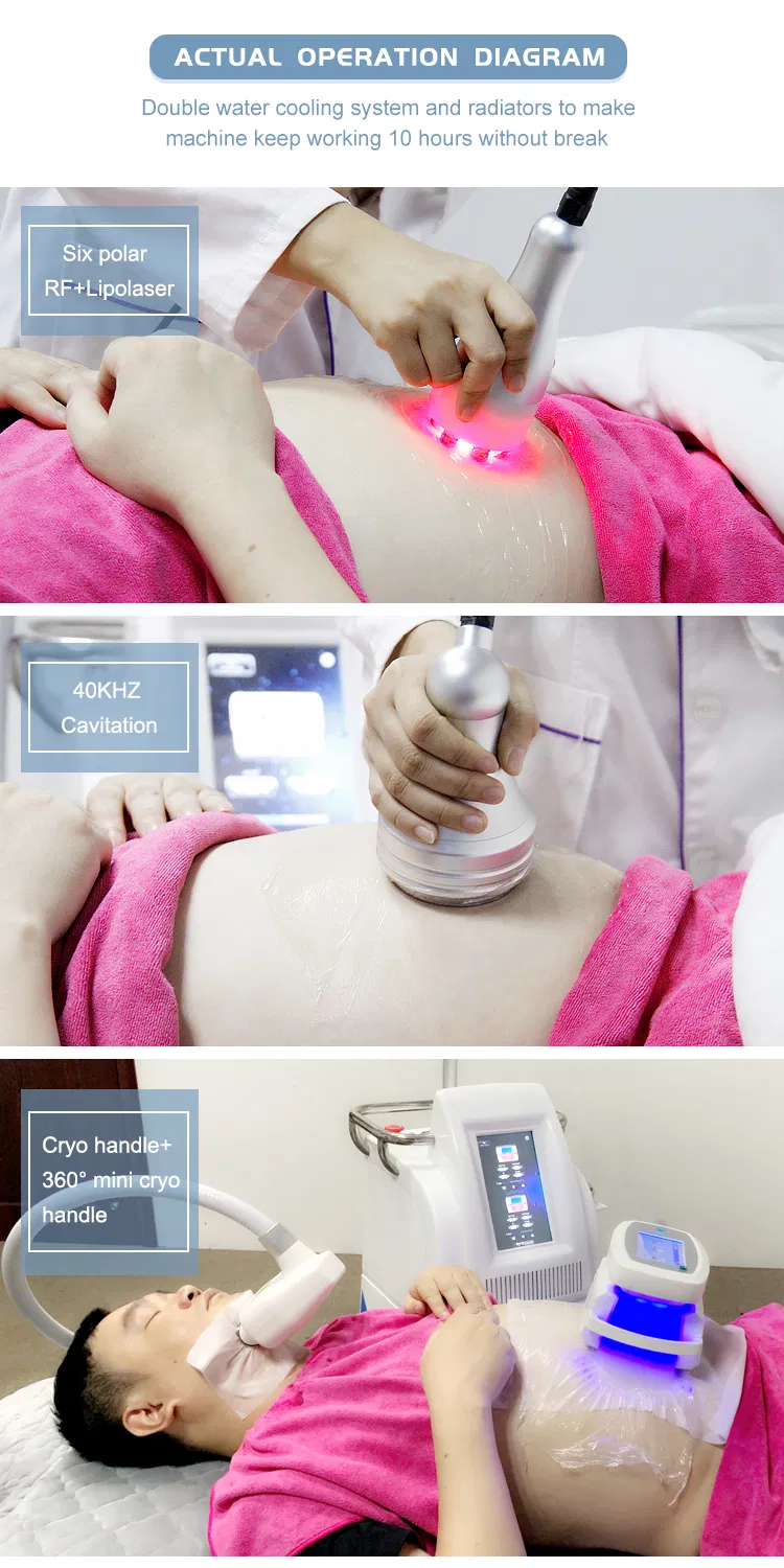 Cool Sculpting Body Contouring RF Ultrasound Cryolipolysis Cavitation