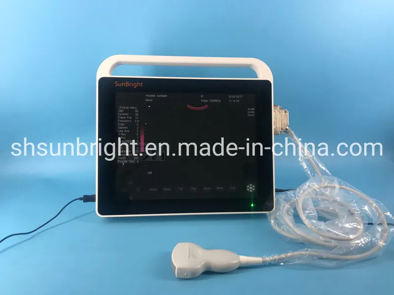 Full-Digital Abdomen Touch Screen Ultrasound Mobile Ultrasound